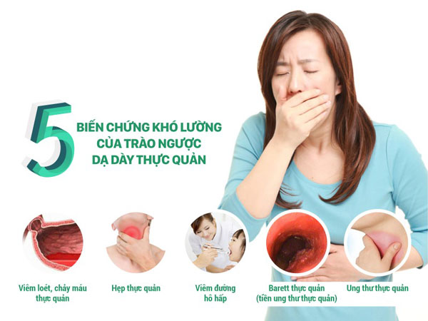 Bệnh trào ngược dạ dày và biến chứng.