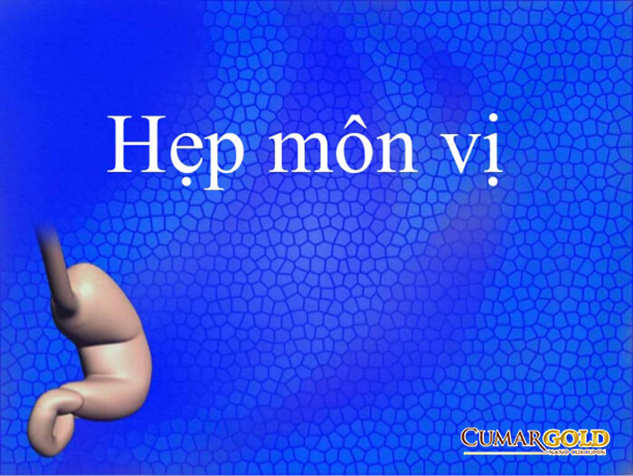 Hẹp môn vị