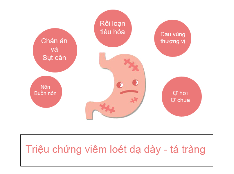 triệu chứng viêm loét dạ dày