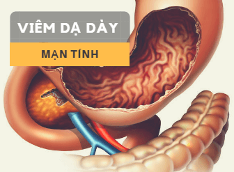 Viêm dạ dày mãn tính