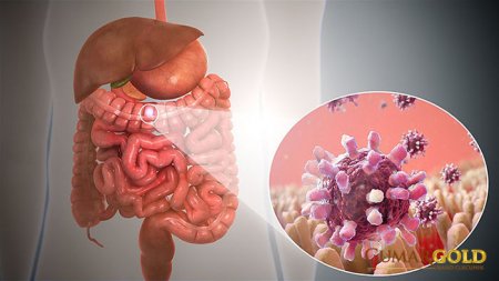 Viêm dạ dày ruột
