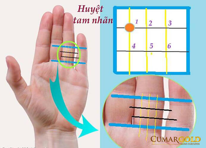 Chữa đau dạ dày tại huyệt tam nhãn