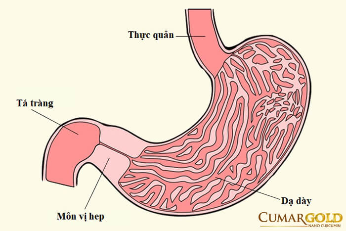 Hẹp môn vị