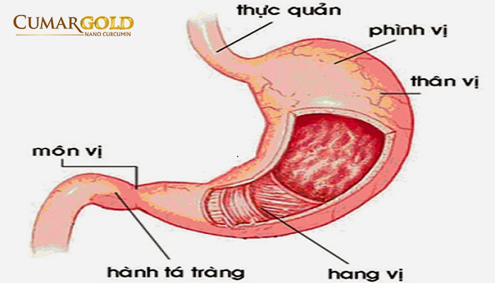 Viêm hang vị dạ dày