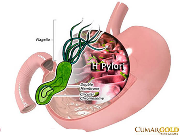 Hình ảnh vi khuẩn hp mô phỏng gây bệnh tại dạ dày