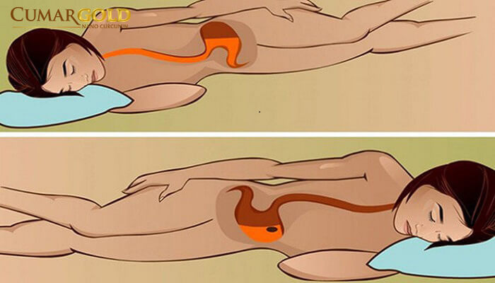 Đau dạ dày nằm bên nào tốt 
