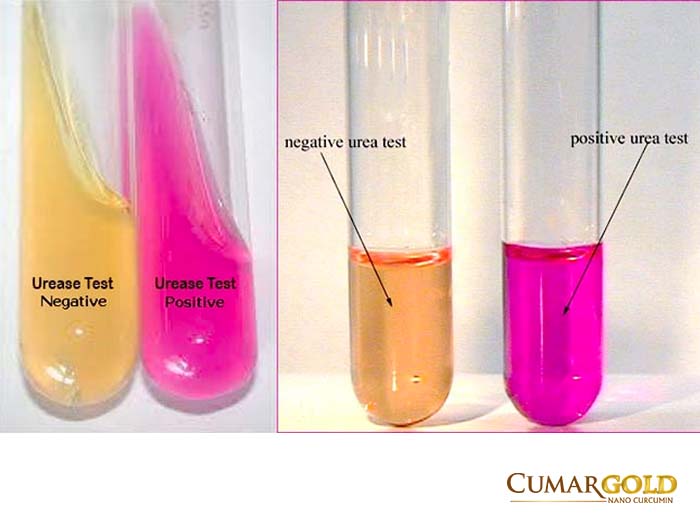 test enzyme ureas