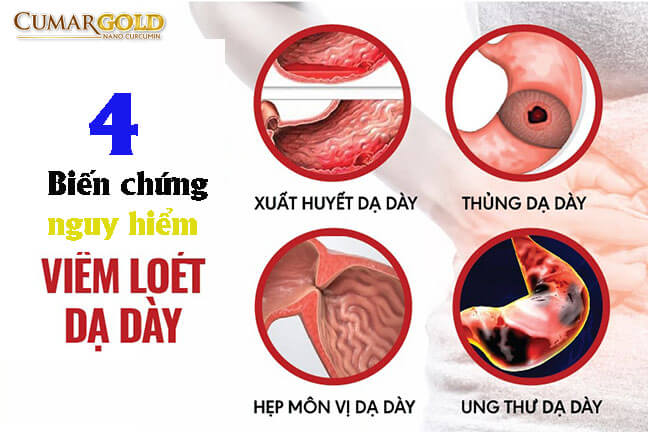 Viêm loét dạ dày tá tràng có nguy hiểm không?