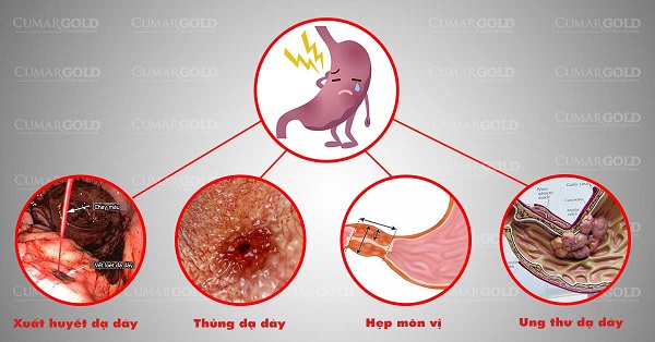 Không tuân thủ liệu trình sẽ gây ra nhiều vấn đề gây khó khăn trong điều trị