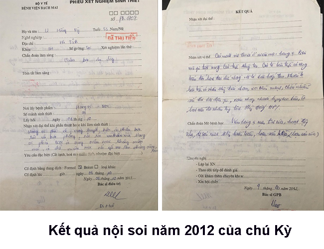 Kết quả nội soi năm 2012 của chú Kỳ